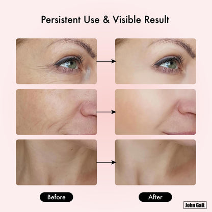 Red Light Therapy Massager for Face and Neck, 7 Color Led W/ Skin Care